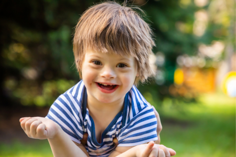 High Rate of Abortion For Down Syndrome Babies